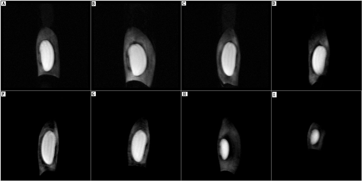 豆荚T1加权像-低场核磁共振成像